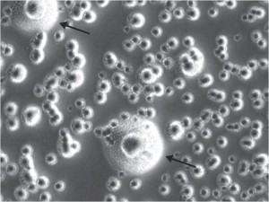 Typical Mycoplasma colony, as shown on nature.com